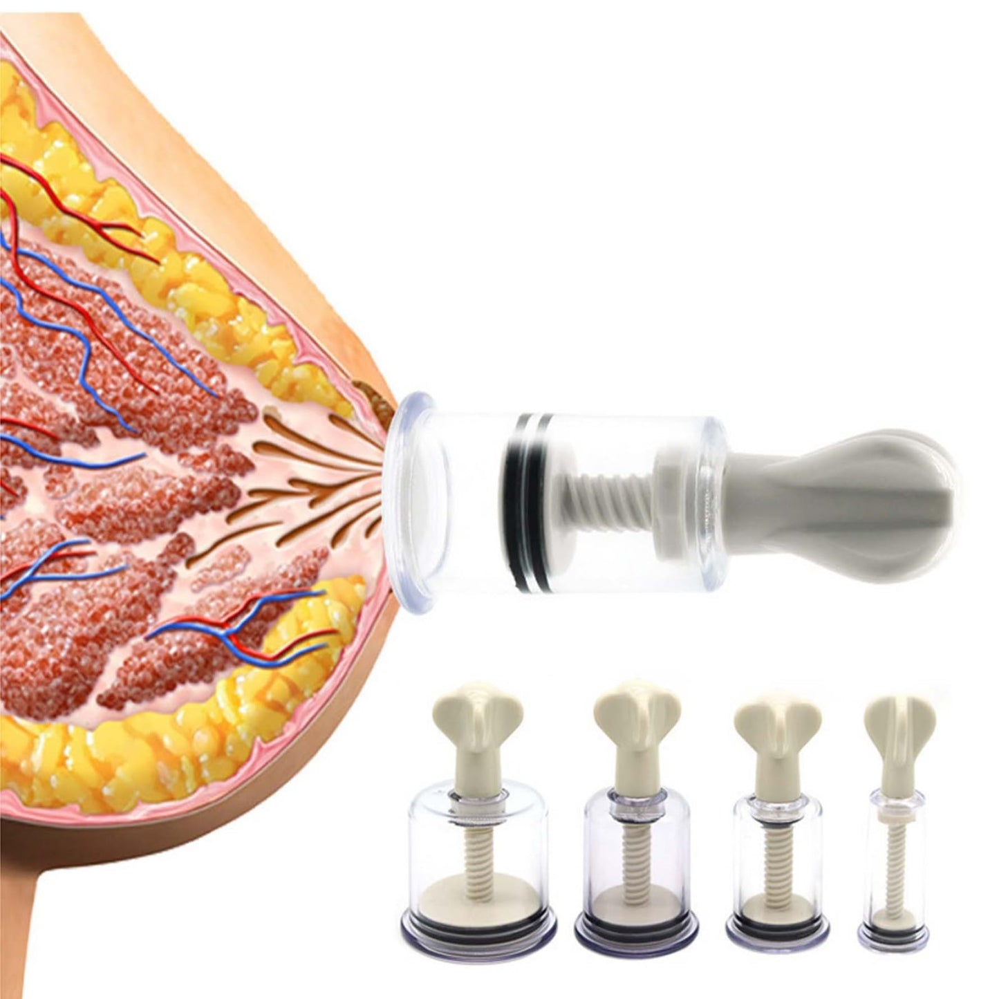 Nipple Extractors for Inverted Flat Nipples